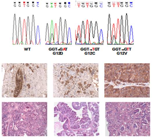 PathologyBiomarker