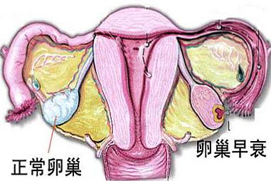 年轻女孩总熬夜,休息不好,卵巢早衰的严重后果你可能想象不到!