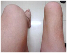 研究病例图片1