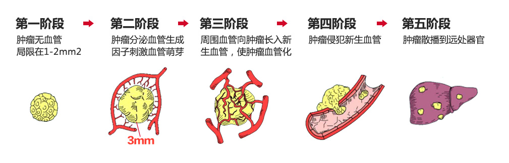 肿瘤生长阶段