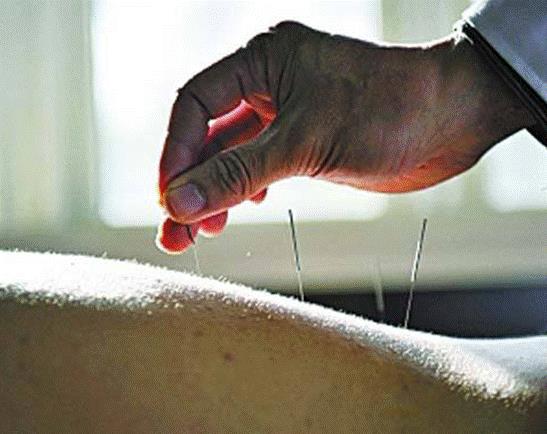 Whenisthefunctionofacupunctureandmoxibustionsuitableforacupunctureandmoxibustion