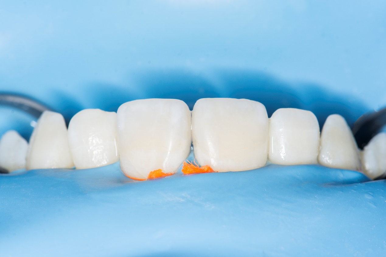 【博康泰】前牙美学树脂修复课程— —4月16日-17日 ，口腔培训，康强培训网