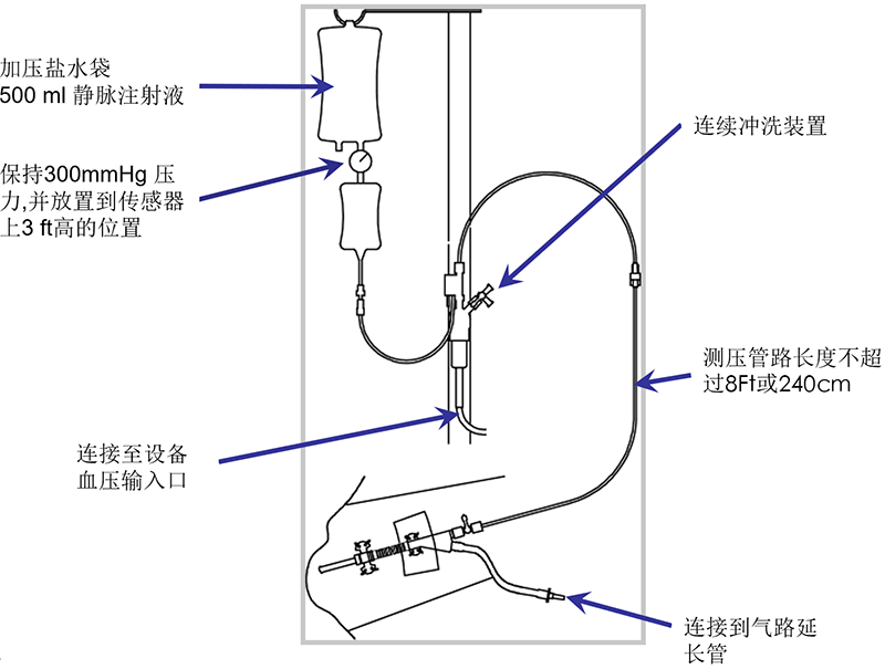 压力传感器.png