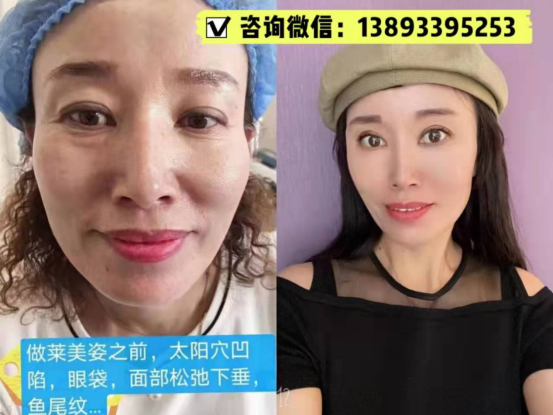 琼滋女王效果怎么样?代理真的赚钱吗?