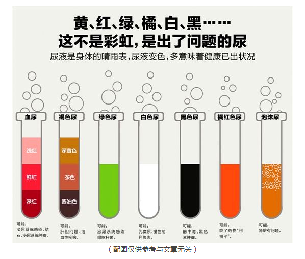 尿液的颜色,透明度,比重,尿 ph 值,尿隐血(潜血,尿红细胞,尿中白细胞