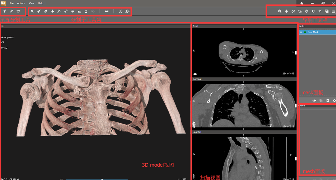 D2p™ From Dicom To Print 将医学图像转换为可打印和可视数据的新方法 企业官网