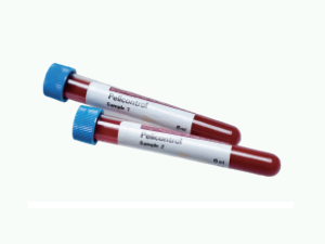 血型鉴定与抗体筛查质控品