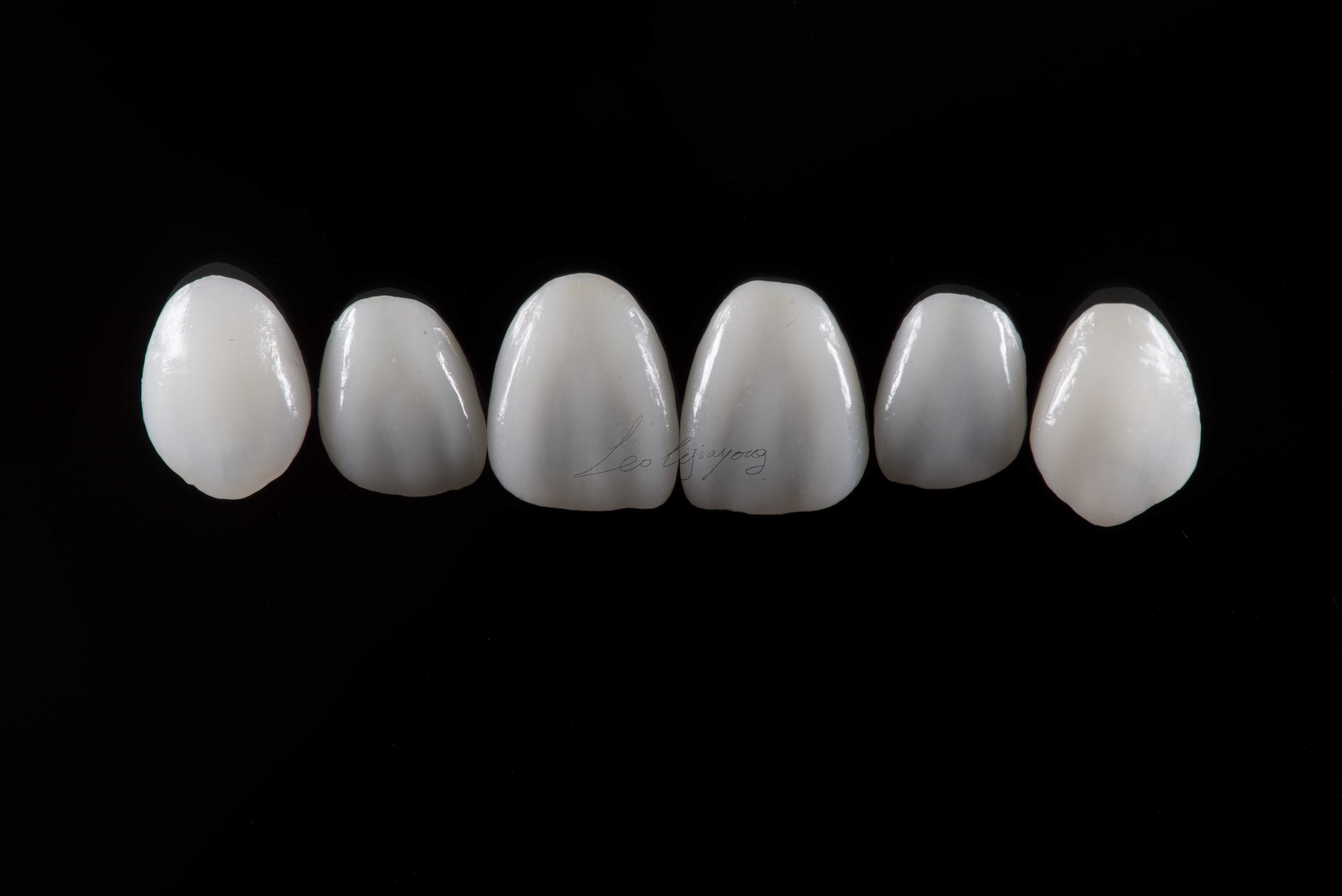 广州种植牙/口腔美学修复中的唇齿关系分析——这样才是好看又好用的种植修复 - 知乎