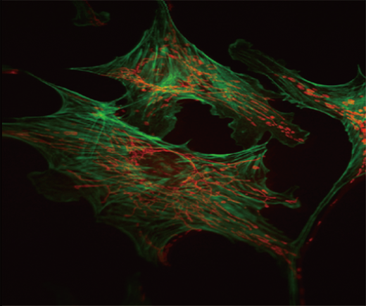 endothelium