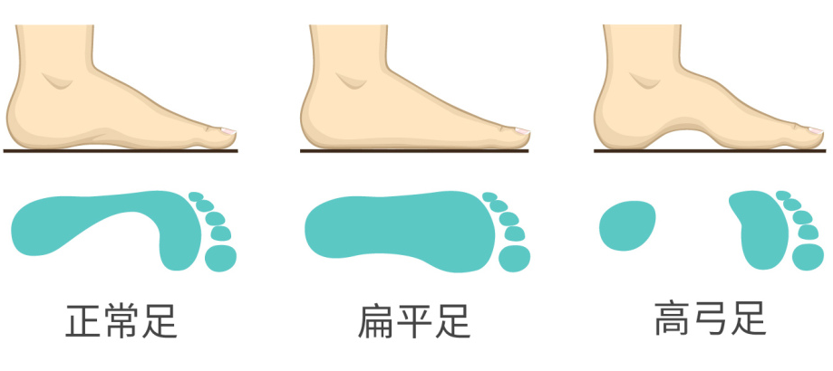 Flat-Feet.jpg