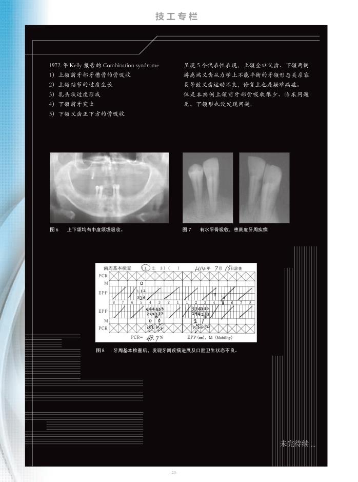 SHOFU LINE 47_页面_20