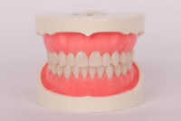 美学牙科模型1