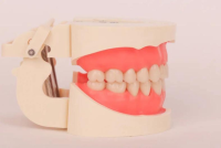 美学牙科模型3