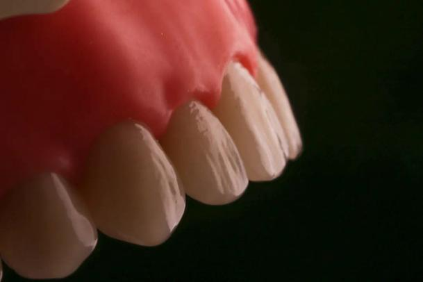 美学牙科模型4