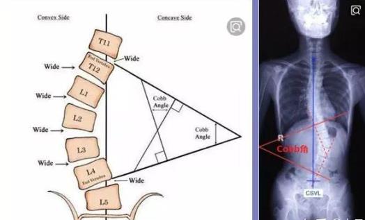 v2-b6f4b36ed8a7dee5a589be8a63574749_r