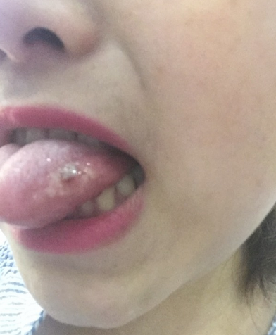 img2