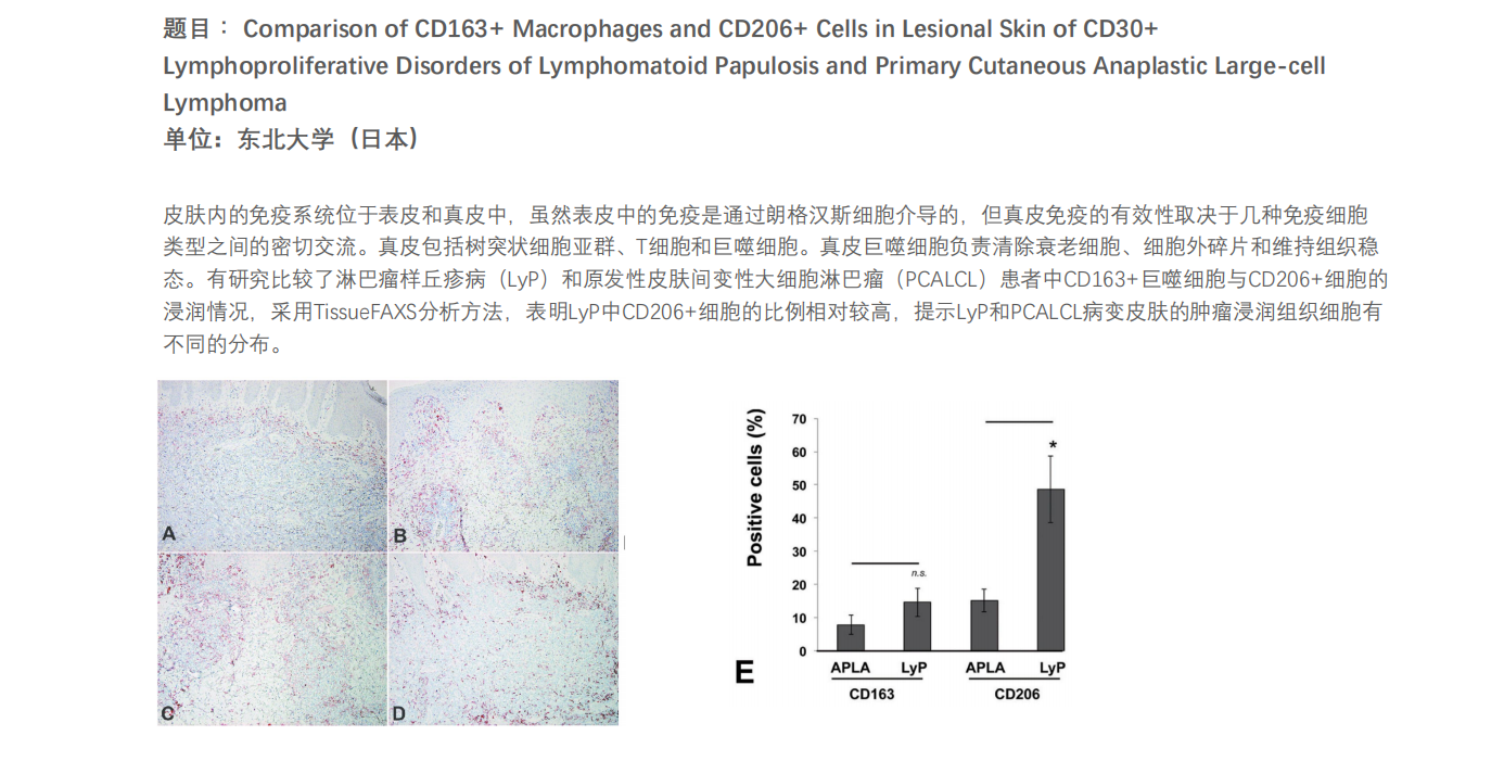 Comparison Of Cd Macrophages And Cd Cells In Lesional Skin Of