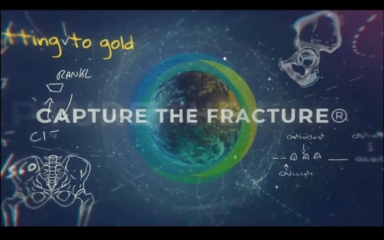 CAPTURE THE FRACTURE