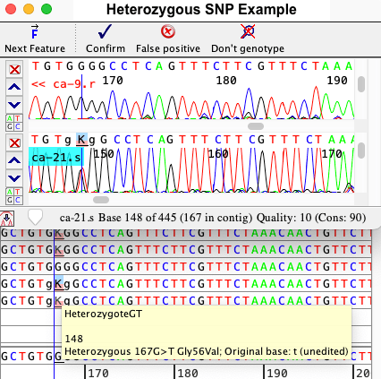CodonCode Aligner 杂合 SNP 色谱峰图示例