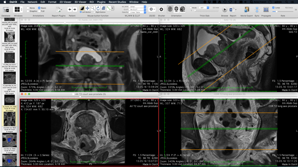 OsiriX MD 图片三
