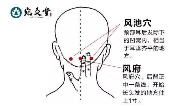 风池的准确位置图图解图片