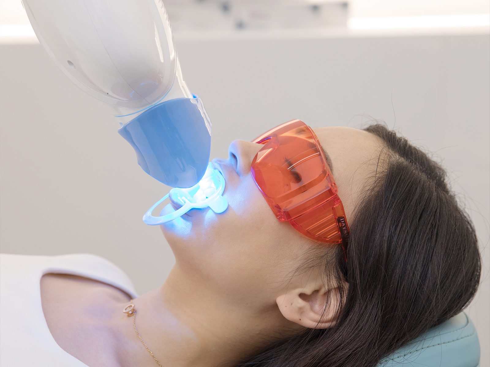 【科普】冷光美白的效果如何?-云南松鼠口腔