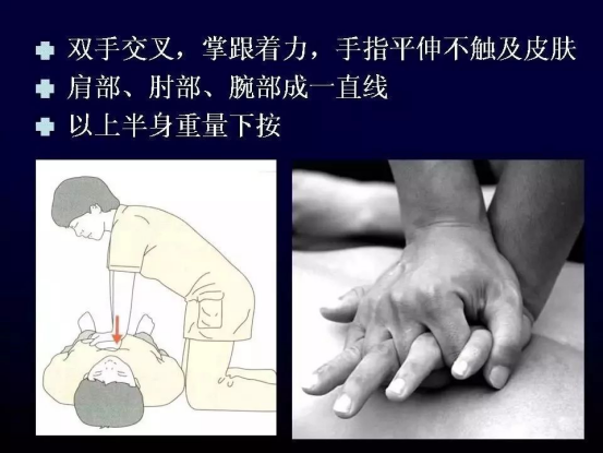 胸痛中心宣传资料7-7