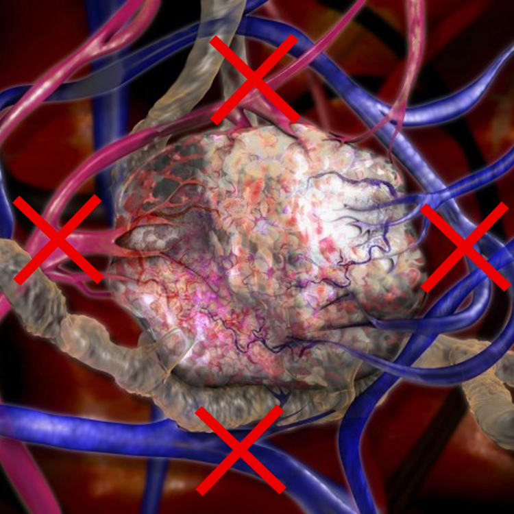 许多的癌症而言,发展并不是一个非常快的过程,它是一个慢性发展的疾病