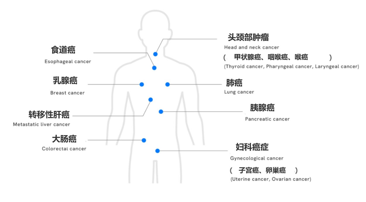 petct筛查的癌症