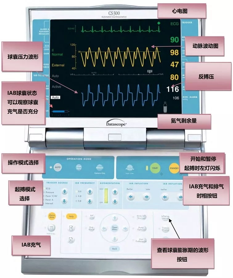 主动脉压力感受器图片