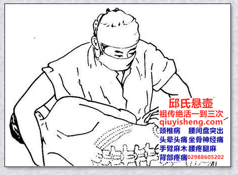 腰间盘突出锻炼-西安邱氏悬壶官网