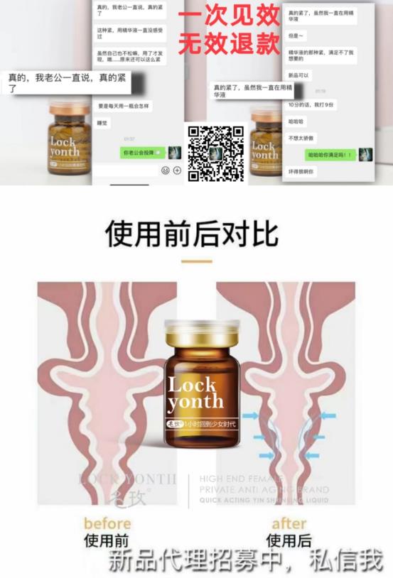 db名玫速效缩阴液零售价多少钱?是全国统一价吗?
