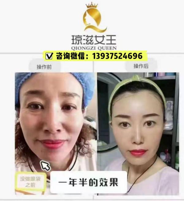 琼滋女王加盟费多少是全国统一零售价吗