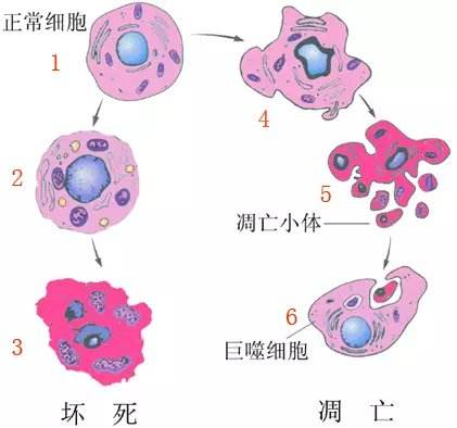 肿瘤细胞简图图片