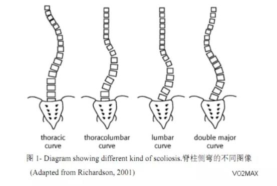 脊柱侧弯2