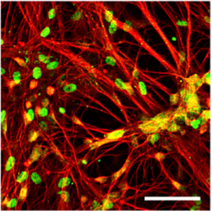 Dopaminergic-neurons