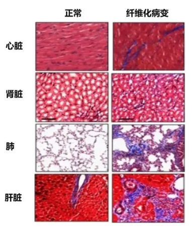 微信截图_20191125152709