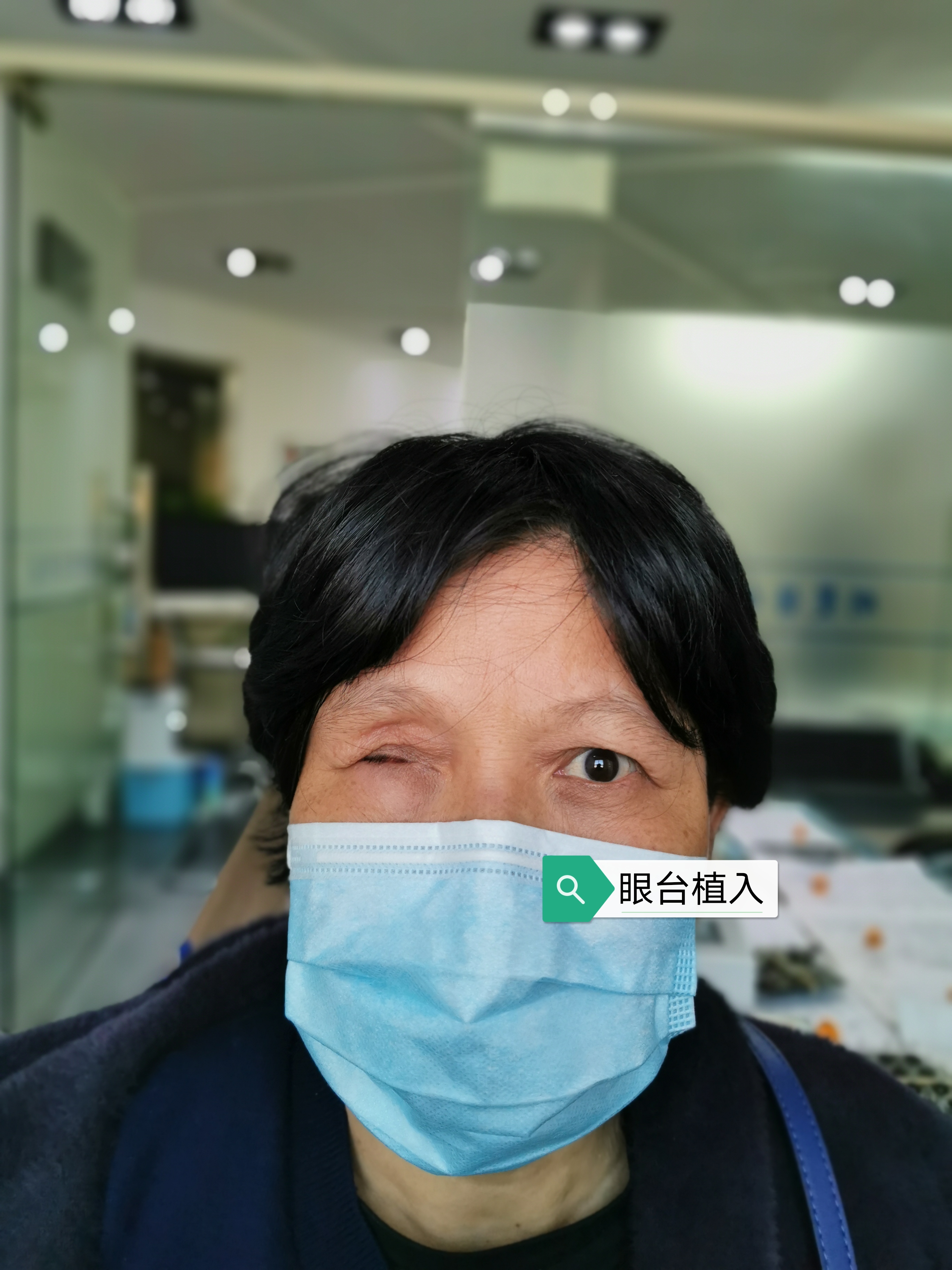 关于义眼片的一些小知识