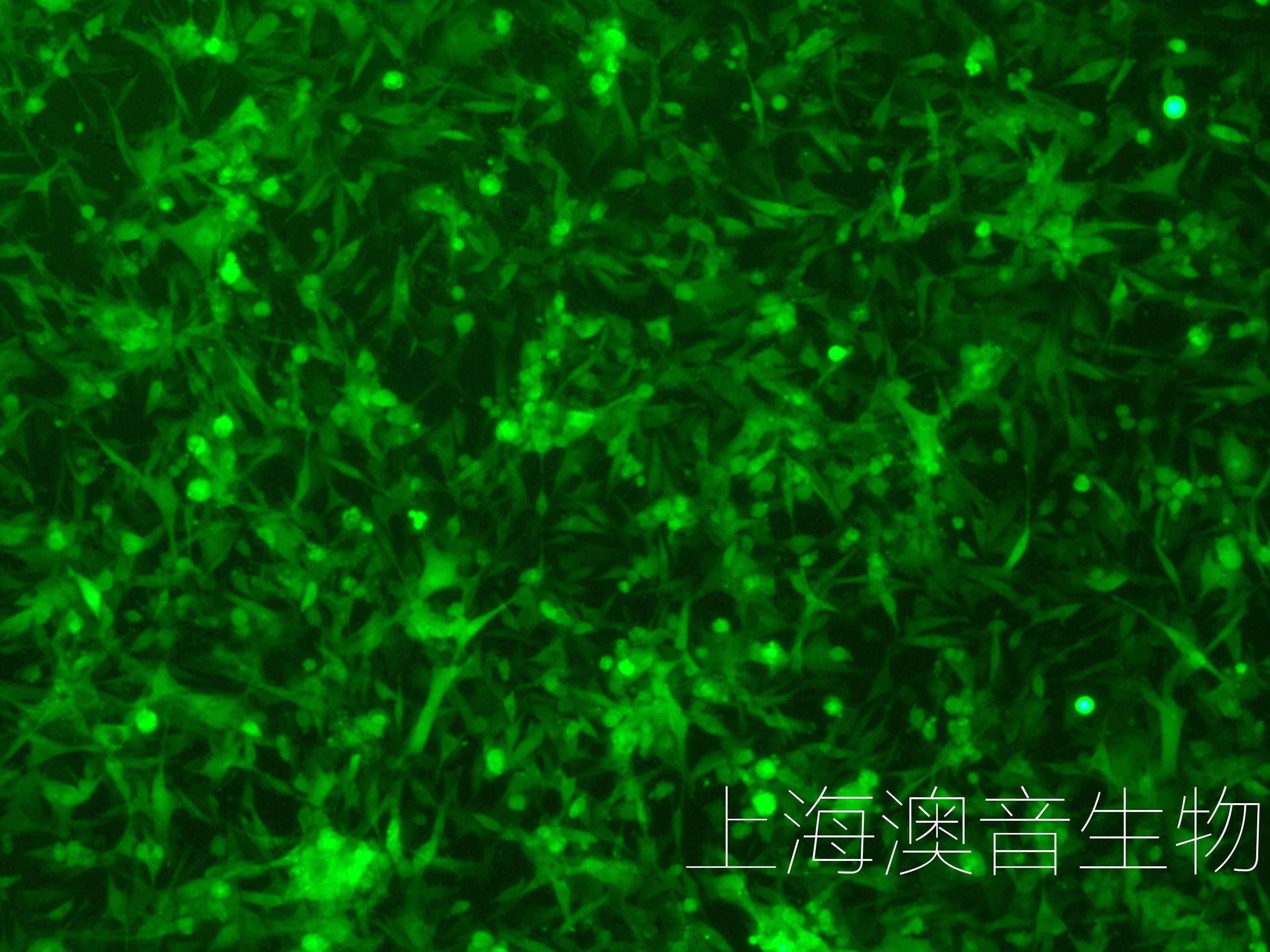 U 87MG LUC GFP Puro u-87mg-luc-gfp-puro