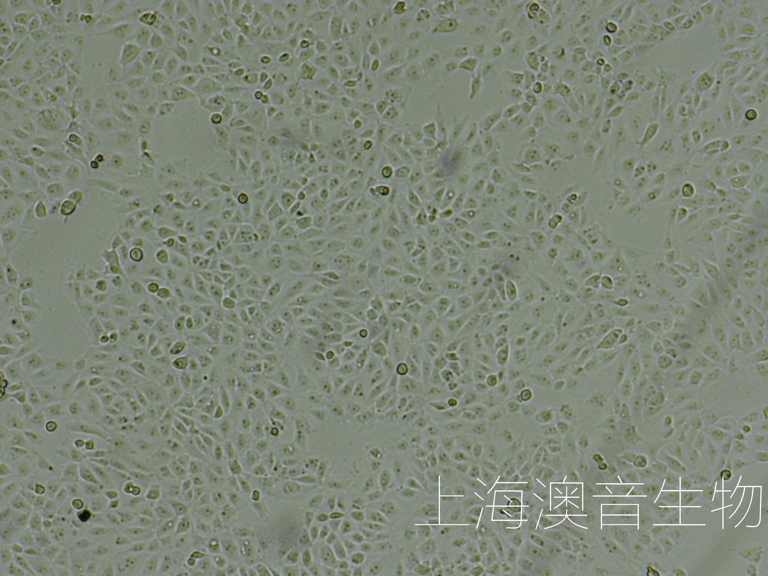 张永亮/习欠云团队在猪乳小细胞外囊泡（sEV）研究取得新进展