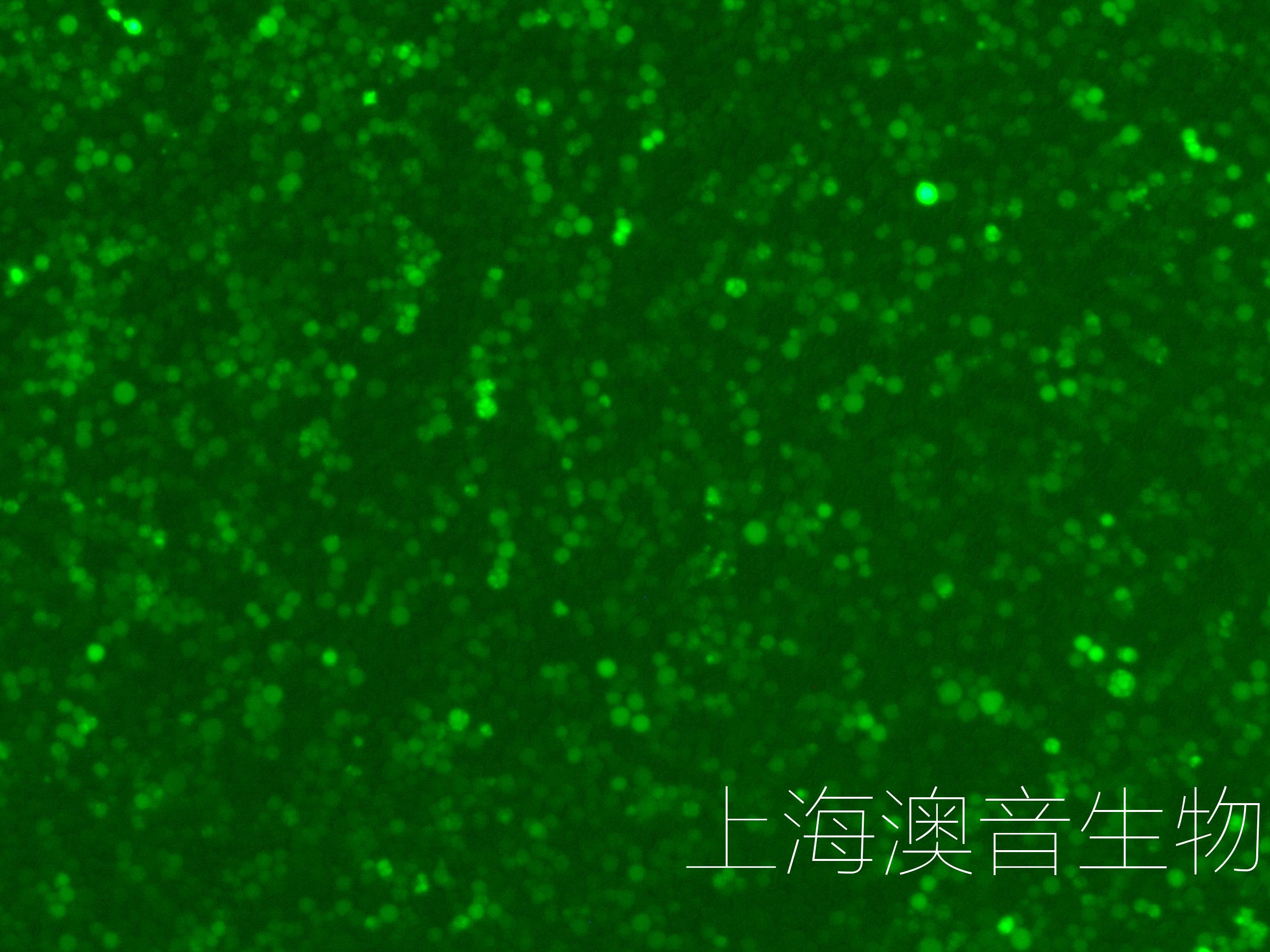 K562-LUC-GFP-Puro双标记的人慢性髓原白血病细胞-企业官网