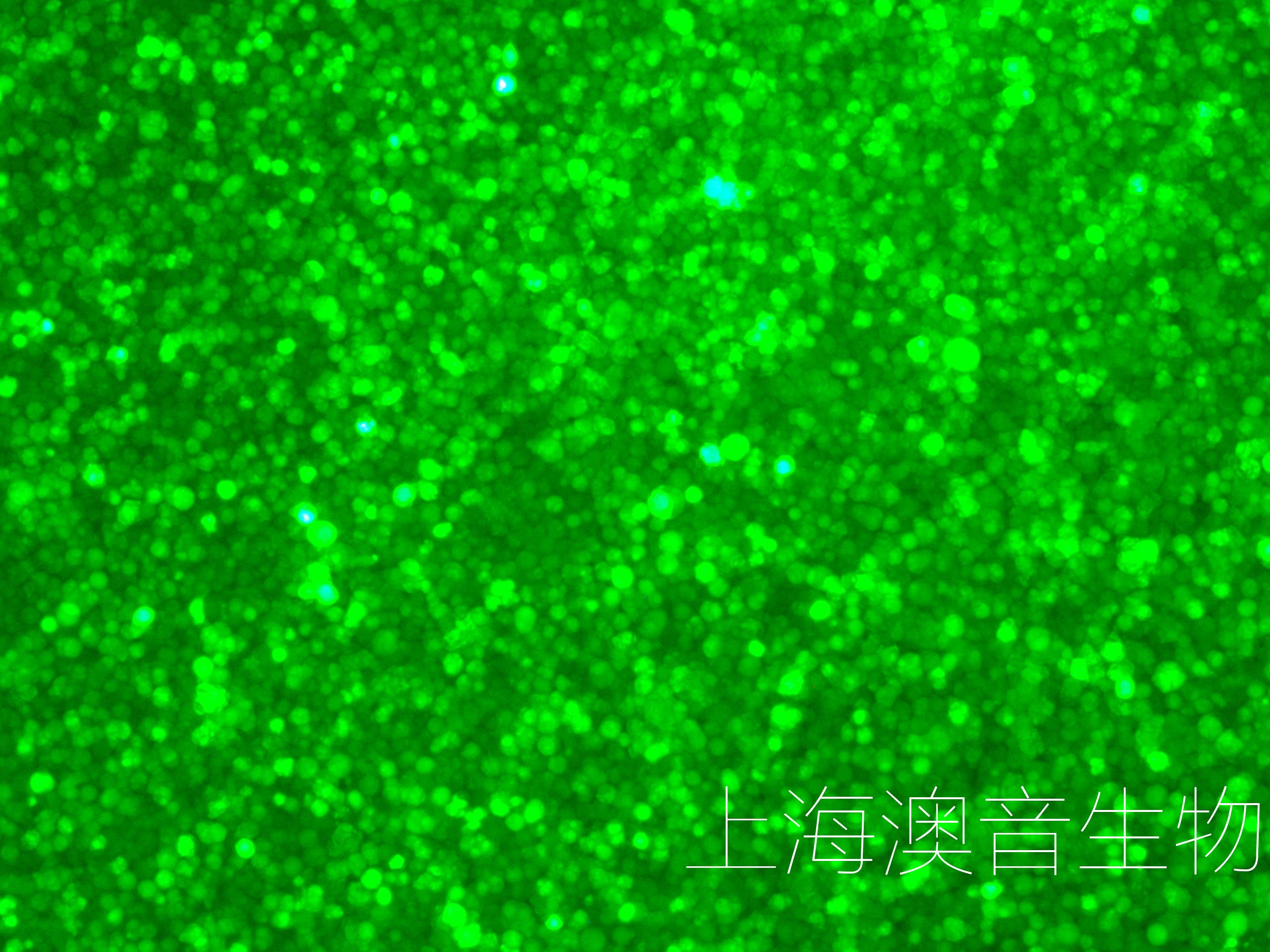 K562-LUC-GFP-Puro双标记的人慢性髓原白血病细胞-企业官网