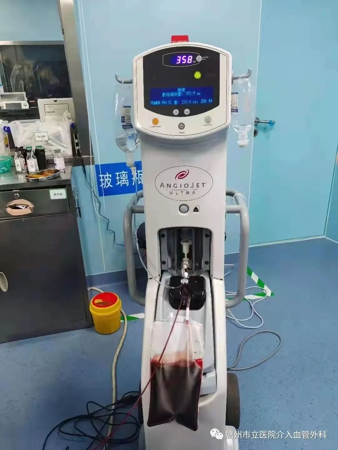 安全有效清除血栓——AngioJet-科室动态-清华大学附属北京清华长庚医院血管外科