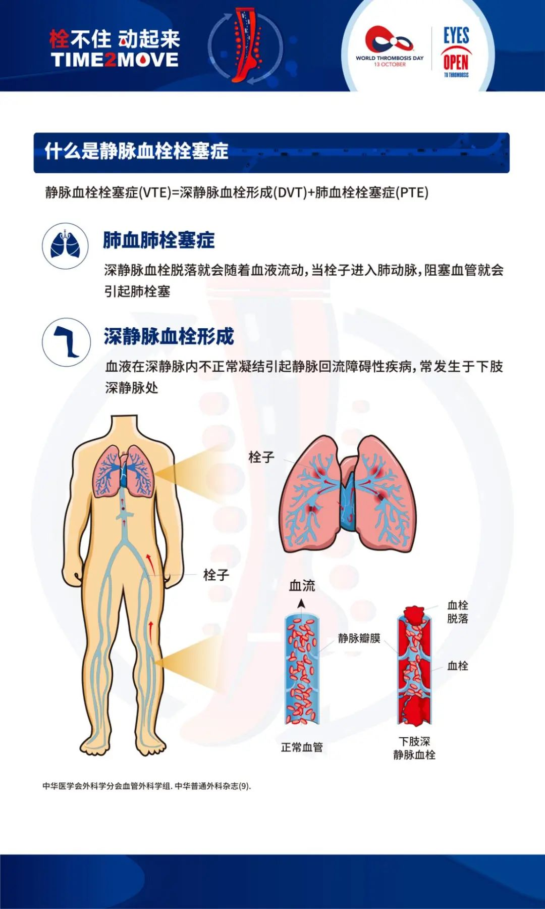 栓不住,动起来 | 我院开展第九个世界血栓日义诊活动-广东省人民医院赣州医院(赣州市立医院)