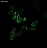 CTB-P1