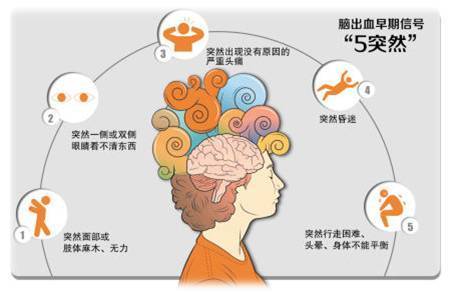 脑出血后遗症请收好这4个康复训练方法,帮助恢复