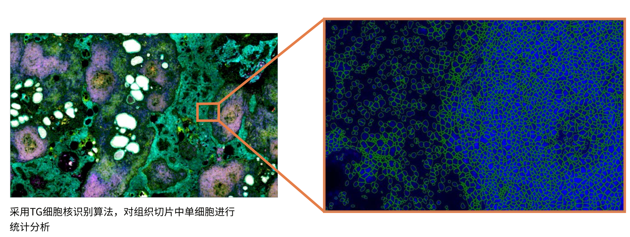 多玛组织图片