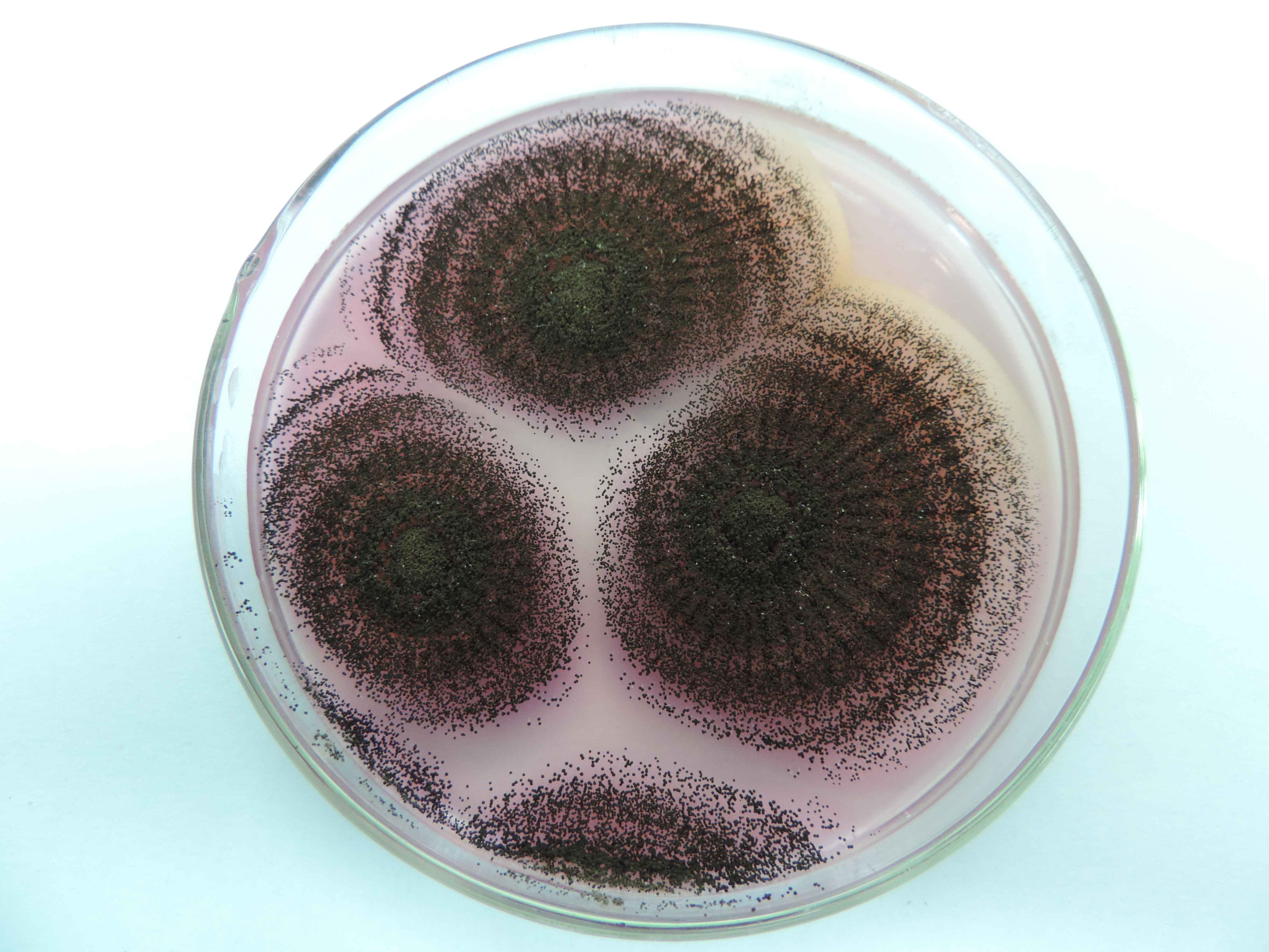 曲霉菌广泛存在于空气和土壤中,常见的曲霉有黑曲霉,黄曲霉,烟曲霉等