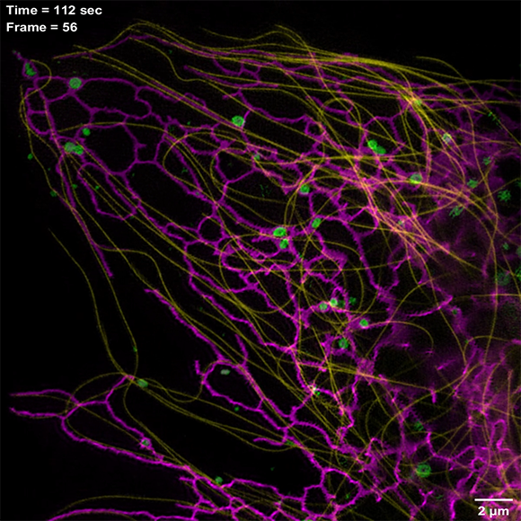 内质网，溶酶体，微管，多色，超分辨成像，互作研究