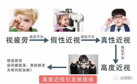 近视误区3